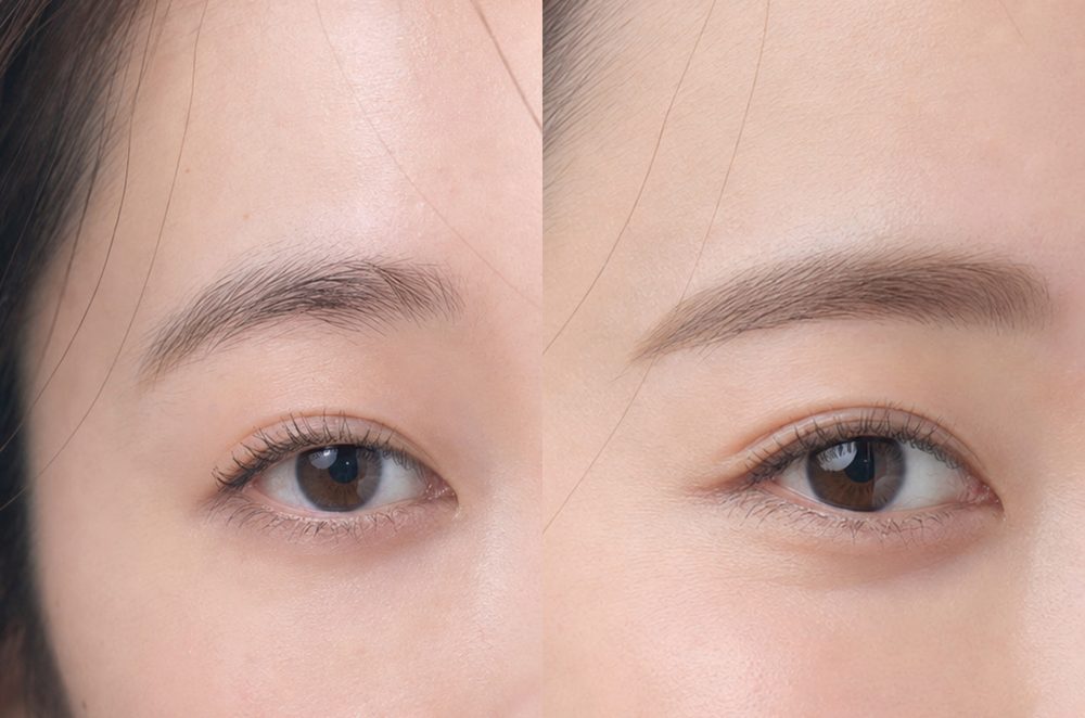 眉毛デザインのビフォーアフター：左右差を整えて印象を均一に